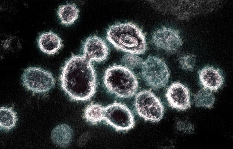 Image of coronavirus under the microscope